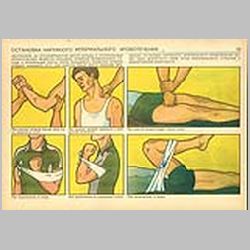 055 Остановка наружного артериального кровотечения