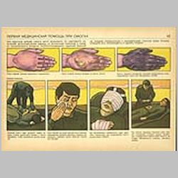 062 Первая медицинская помощь при ожогах